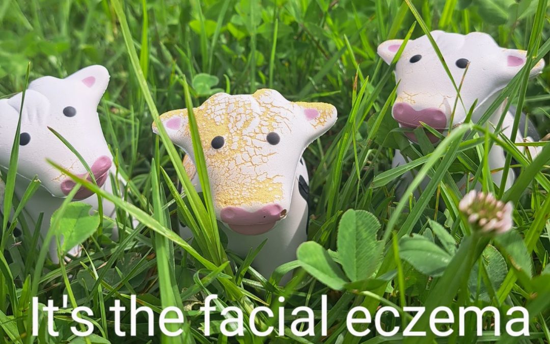 Facial Eczema in Cattle